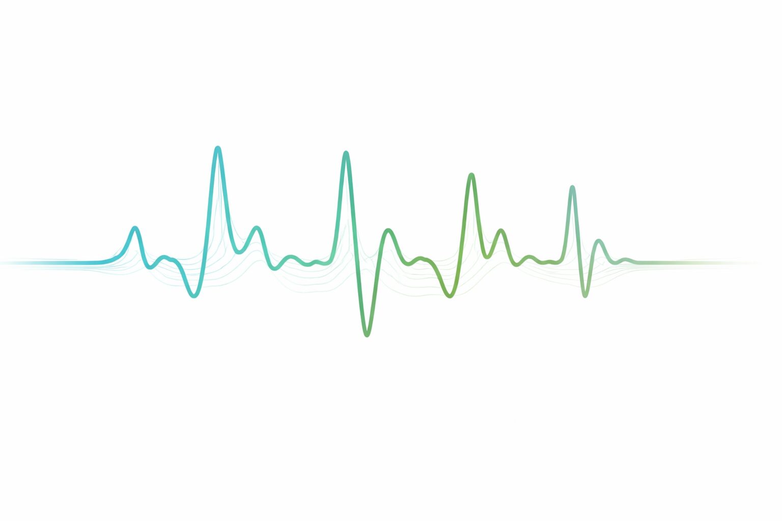 heart rate variability waveform showing HRV patterns